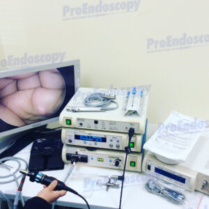 Smith&Nephew 460P Arthroscopy Set Complete w/ PowerMax Elite 72200616
