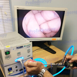 ConMed-Linvatec IM4000 Video Endoscopy Set w/ T4300R Arthroscope
