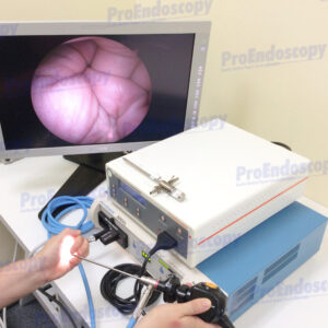Smith&Nephew-Dyonics Video Endoscopy Set w/ 3894 Arthroscope