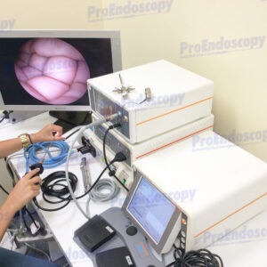 Smith&Nephew-Dyonics 7206084 Video Set w/ 3894 Arthroscope