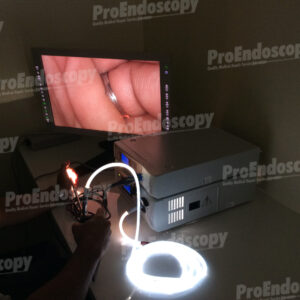 Stryker 1188HD Video Endoscopy Set
