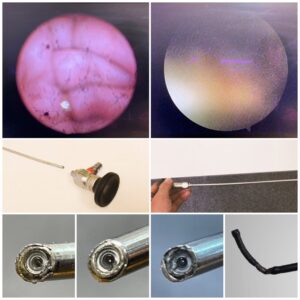 Image repair on rigid endoscopes